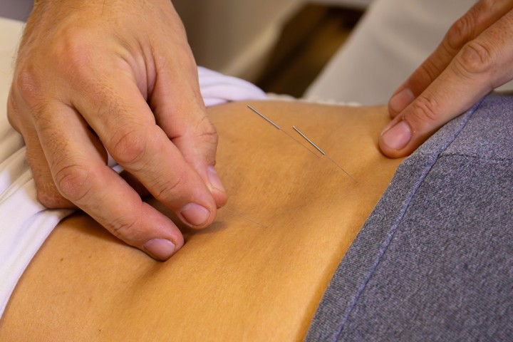 FOTO 4D ACUPUNTURA SISTEMICA jpg.jpg